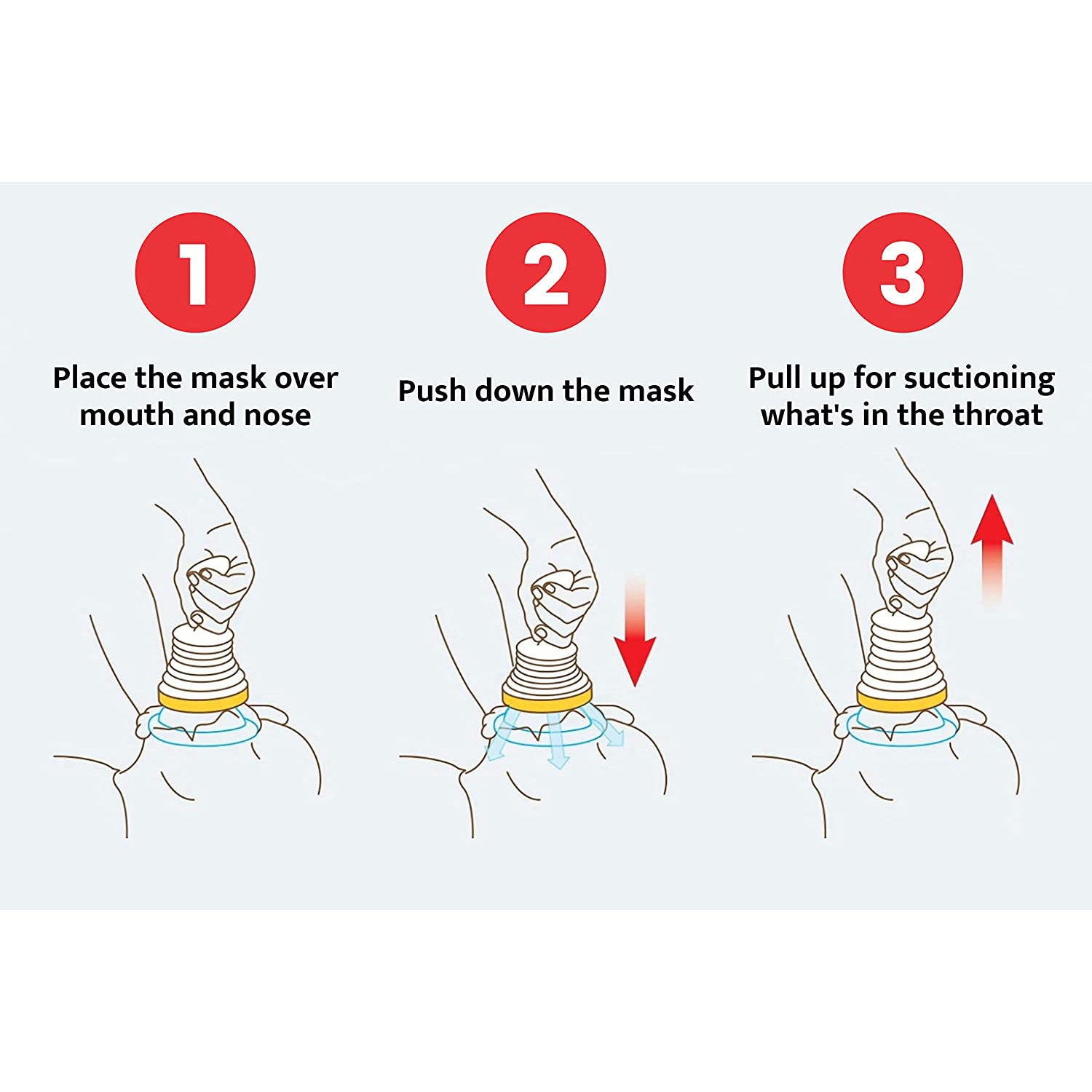 Choking Emergency Device