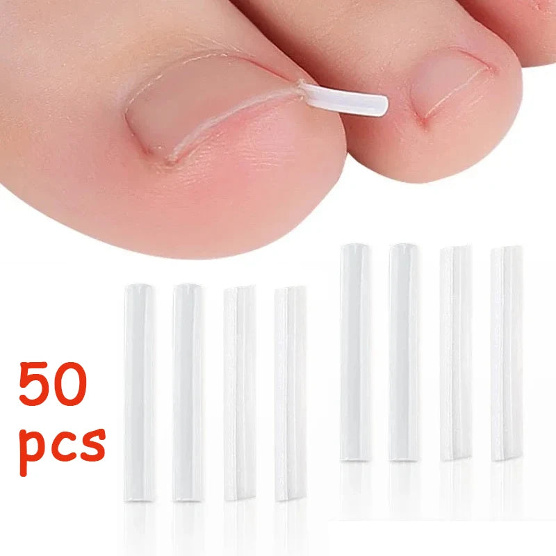 50Pcs Inward Toe Nail Shaping Tool Invisible Nail Care Pad Groove Adjust Clip Accessory Foot Care Tool