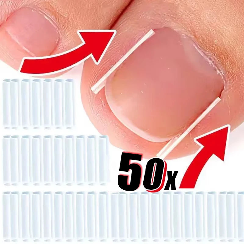 50Pcs Inward Toe Nail Shaping Tool Invisible Nail Care Pad Groove Adjust Clip Accessory Foot Care Tool