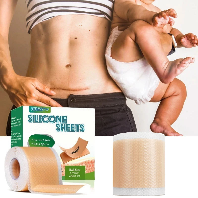 4*150/300 Cm Invisible Silicone Scar Patch1roll Self-Adhesive Tape Skin Care Waterproof Beauty Sticker Reusable Effective Patch