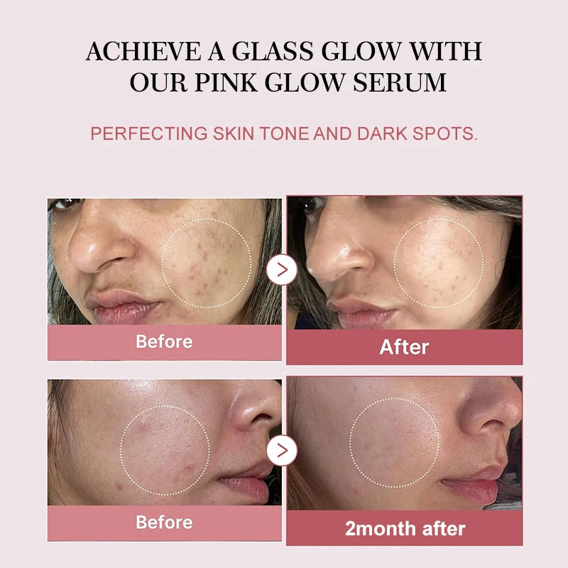 Korean Salmon PDRN Collagen Serum Fix Dull Skin Boost Elasticity Promote Skin Regeneration Repair Damaged Skin