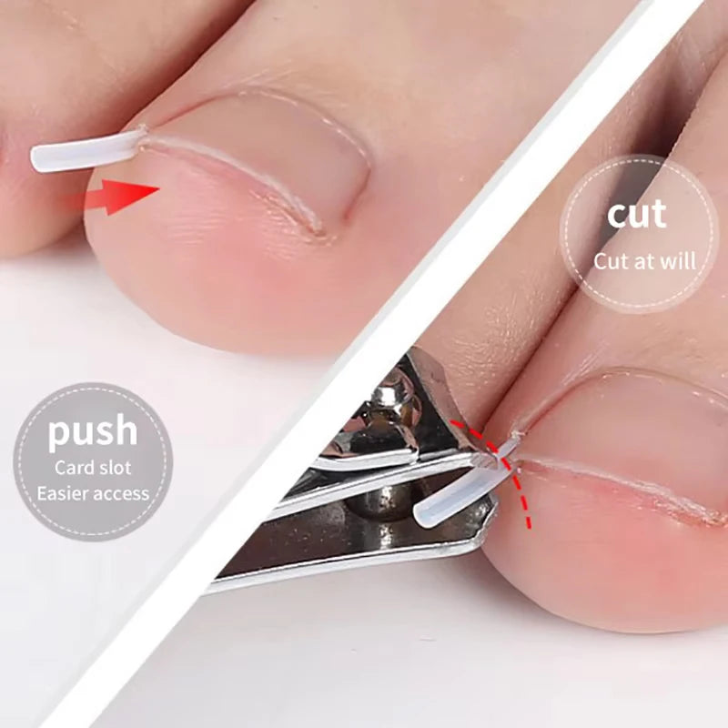 50Pcs Inward Toe Nail Shaping Tool Invisible Nail Care Pad Groove Adjust Clip Accessory Foot Care Tool