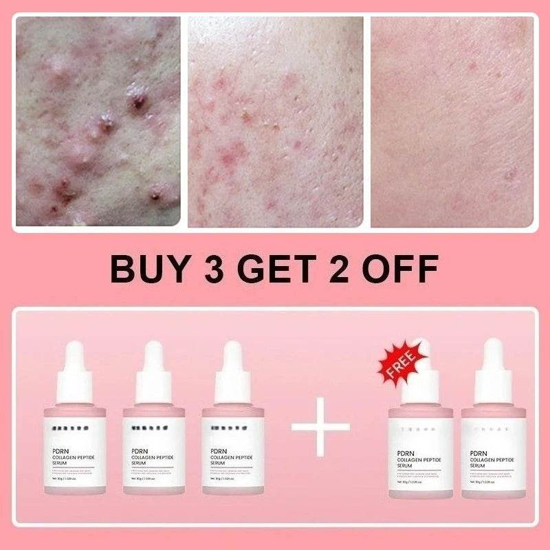 Korean Salmon PDRN Collagen Serum Fix Dull Skin Boost Elasticity Promote Skin Regeneration Repair Damaged Skin