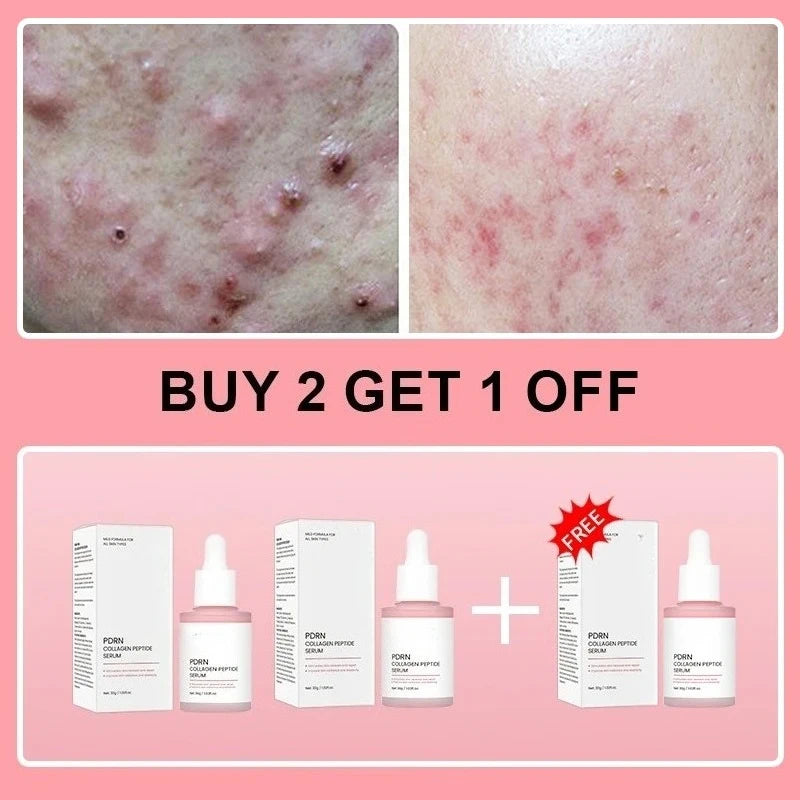 Korean Salmon PDRN Collagen Serum Fix Dull Skin Boost Elasticity Promote Skin Regeneration Repair Damaged Skin